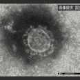 新型肺炎コロナウイルス 国内で再検査の３人感染確認 国内での確認は23人にのイメージ画像